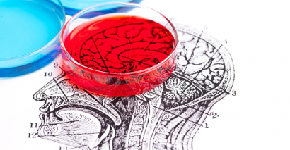 Petri dish covering a scientific assessment to monitor the pupil progress of secondary science students