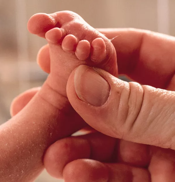 Premature baby